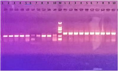 Effects of HAR1 on cognitive function in mice and the regulatory network of HAR1 determined by RNA sequencing and applied bioinformatics analysis